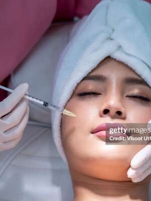 Bandas del Cuello (Platysma)
